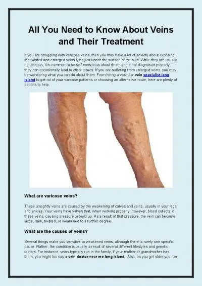 All You Need to Know About Veins and Their Treatment