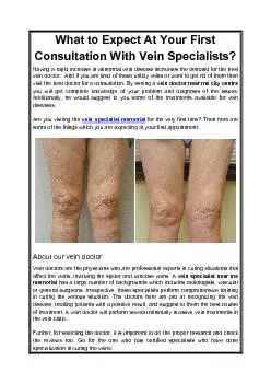 What to Expect At Your First Consultation With Vein Specialists