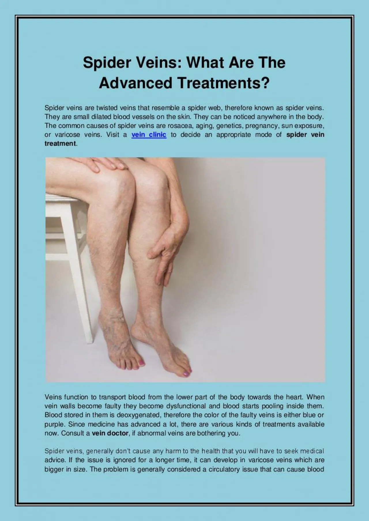 PDF-Spider Veins What Are The Advanced Treatments