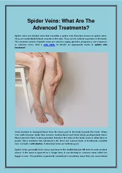 Spider Veins What Are The Advanced Treatments