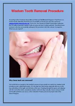 Wisdom Tooth Removal Procedure