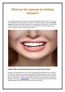 What are the reasons for Getting Veneers?