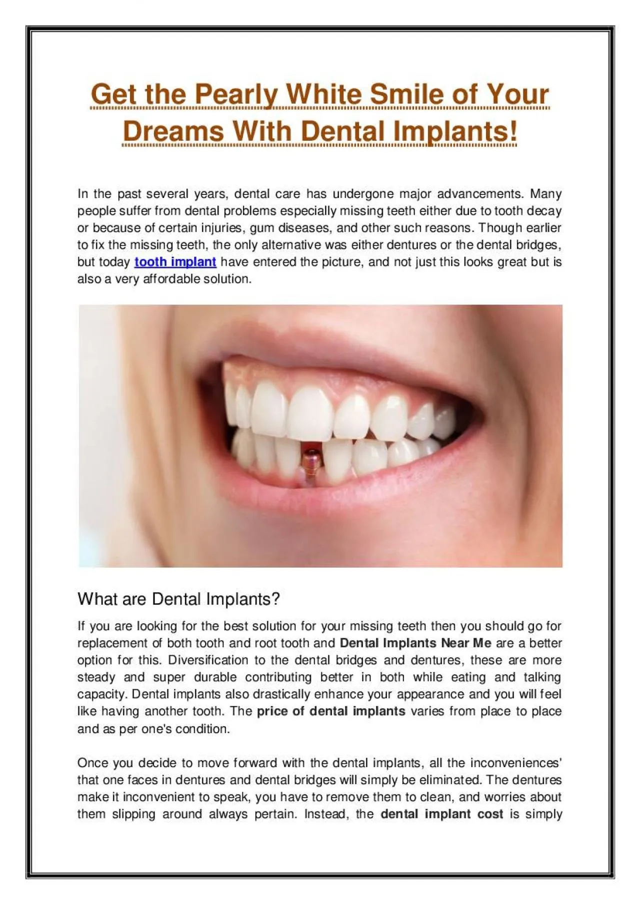 PDF-Get the Pearly White Smile of Your Dreams With Dental Implants!