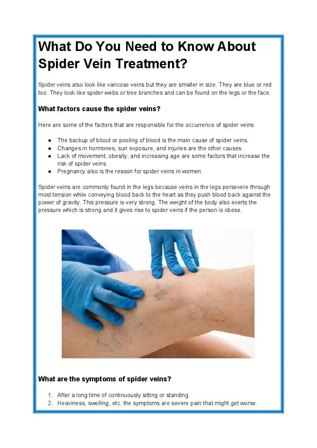 PDF-What Do You Need to Know About Spider Vein Treatment?