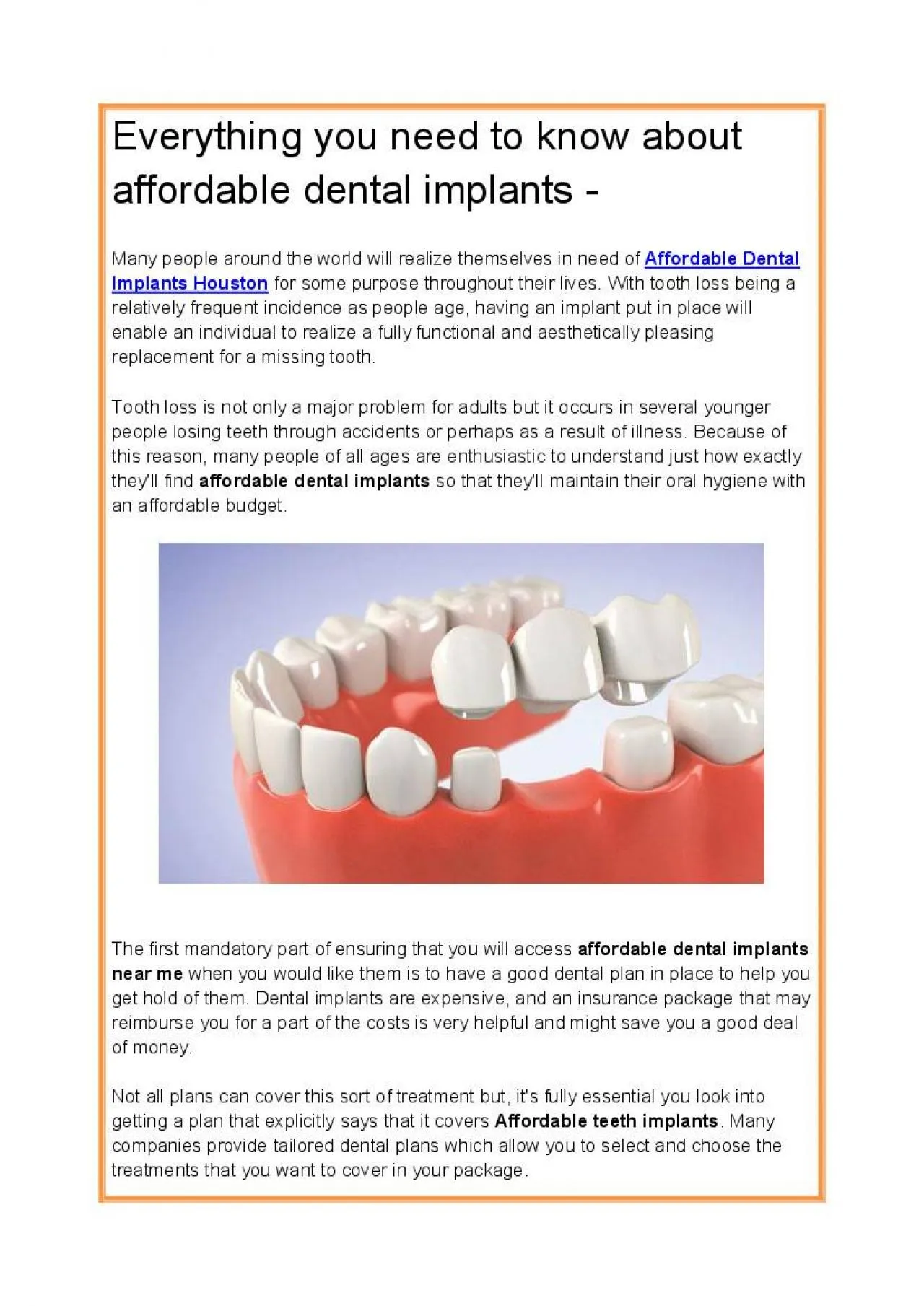 PDF-Everything you need to know about affordable dental implants