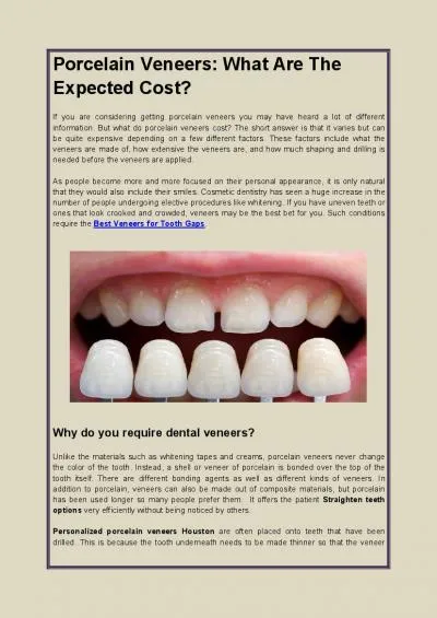 Veneers Teeth: Everything That You Need To Know About Porcelain Veneers.