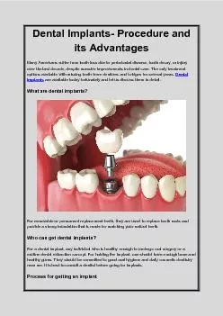 Dental Implants- Procedure and its Advantages