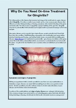 Why Do You Need On-time Treatment for Gingivitis