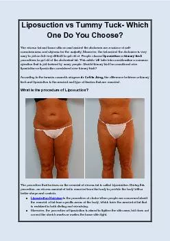 Liposuction vs Tummy Tuck Which One Do You Choose