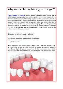Why are dental implants good for you