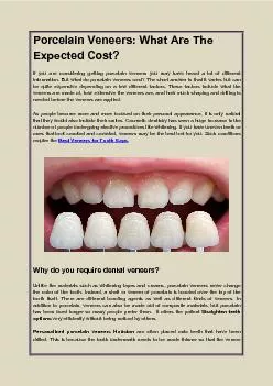 Porcelain Veneers What Are The Expected Cost