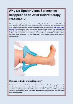 Why Do Spider Veins Sometimes Reappear Soon After Sclerotherapy Treatment