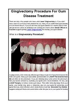 Gingivectomy Procedure For Gum Disease Treatment