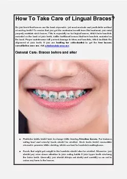 How To Take Care of Lingual Braces?