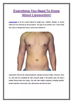 PDF-Everything You Need To Know About Liposuction!