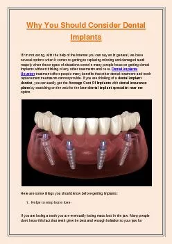 Why You Should Consider Dental Implants