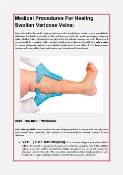 Medical Procedures For Healing Swollen Varicose Veins: