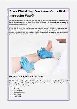 Does Diet Affect Varicose Veins IN A Particular Way?