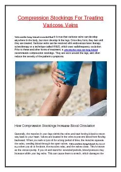 Compression Stockings For Treating  Varicose Veins