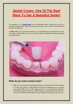 Dental Crown: One Of The Best Ways To Get A Beautiful Smile?