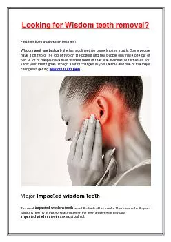 Looking for Wisdom teeth removal?