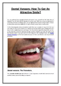 PDF-Dental Veneers: How To Get An Attractive Smile?