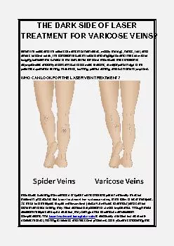 THE DARK SIDE OF LASER TREATMENT FOR VARICOSE VEINS?