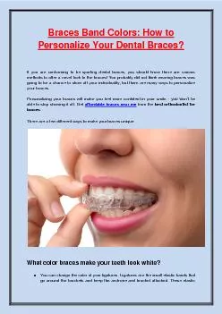 Braces Band Colors: How to Personalize Your Dental Braces?