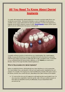 All You Need To Know About Dental Implants