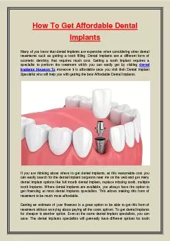 How To Get Affordable Dental Implants
