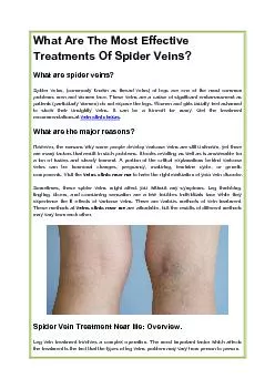 What Are The Most Effective Treatments Of Spider Veins?