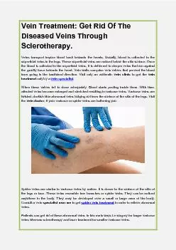 Vein Treatment: Get Rid Of The Diseased Veins Through Sclerotherapy.