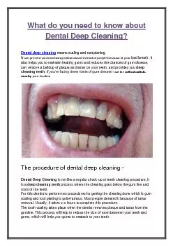 What do you need to know about Dental Deep Cleaning?