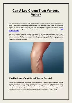 Can A Leg Cream Treat Varicose Veins?