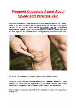 Frequent Questions Asked About Spider And Varicose Vein