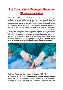Are Your  Veins Damaged Because Of Varicose Veins