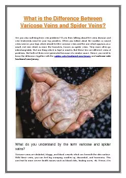 PDF-What is the Difference Between Varicose Veins and Spider Veins?