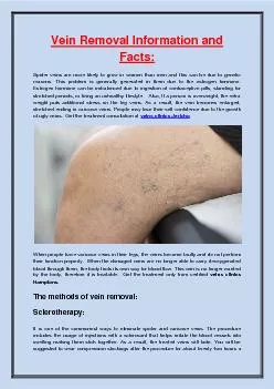 Vein Removal Information and Facts:
