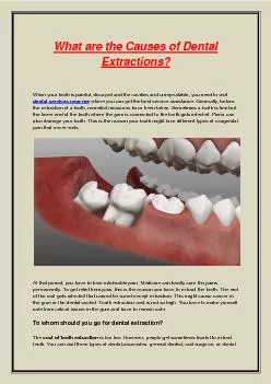 What are the Causes of Dental Extractions?