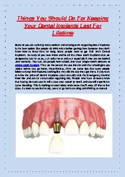 PDF-Things You Should Do For Keeping Your Dental Implants Last For Lifetime