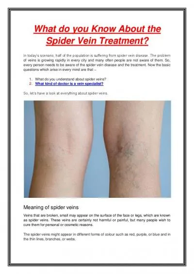 What do you Know About the Spider Vein Treatment?