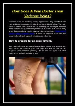 How Does A Vein Doctor Treat Varicose Veins?