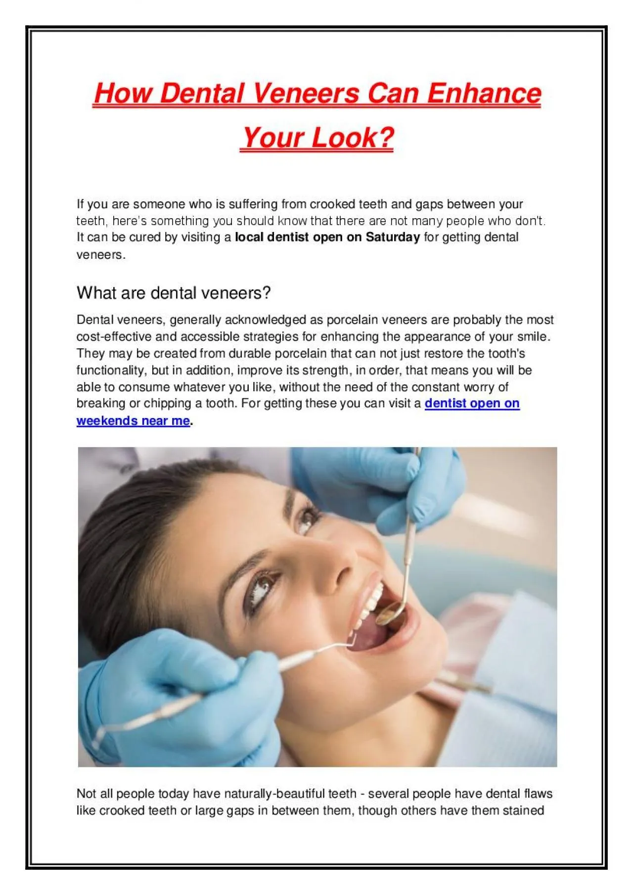 PDF-How Dental Veneers Can Enhance Your Look?