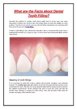 What are the Facts about Dental Tooth Filling?