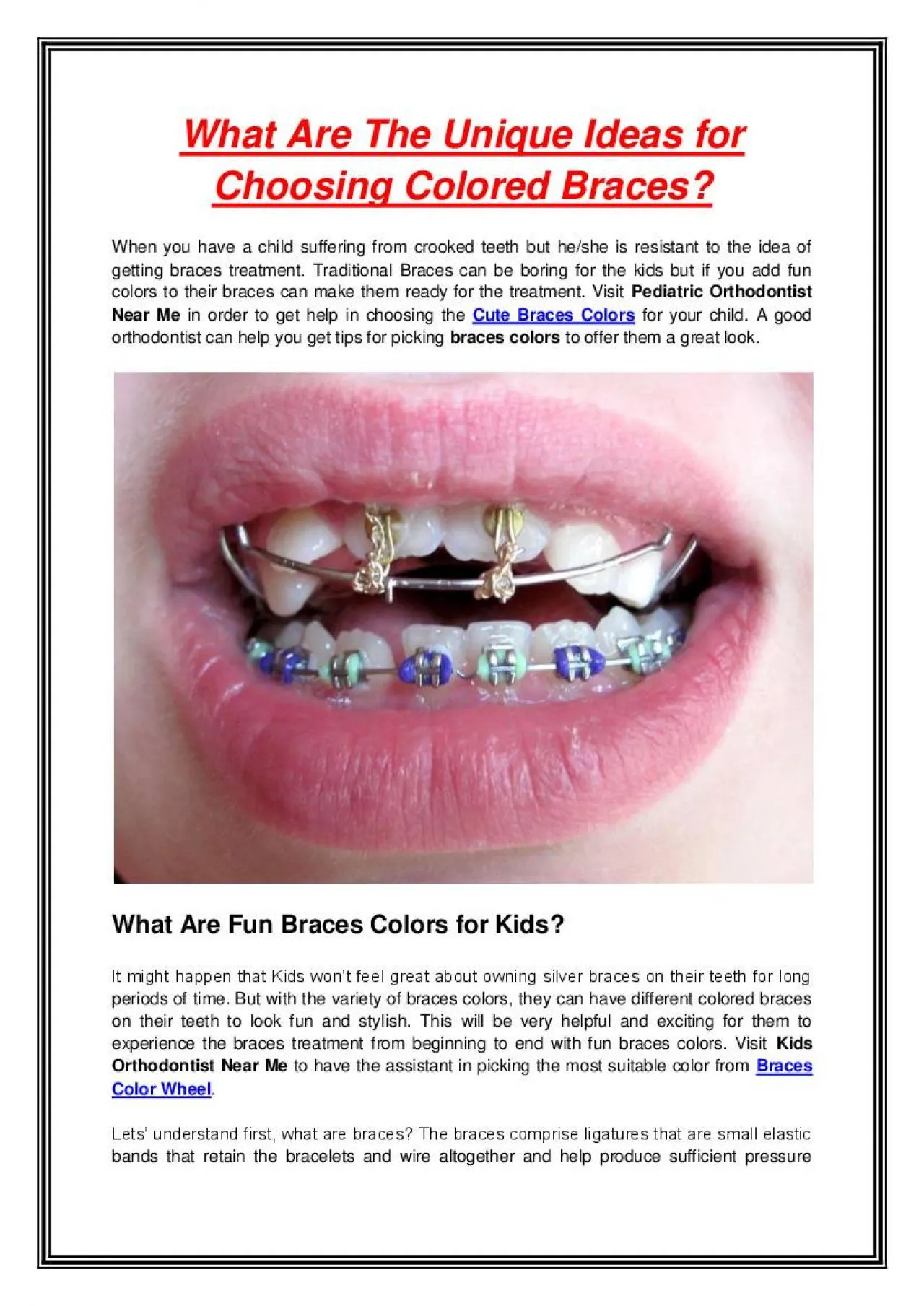 What Are The Unique Ideas for Choosing Colored Braces?