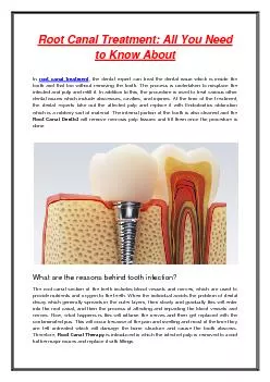 Root Canal Treatment: All You Need to Know About