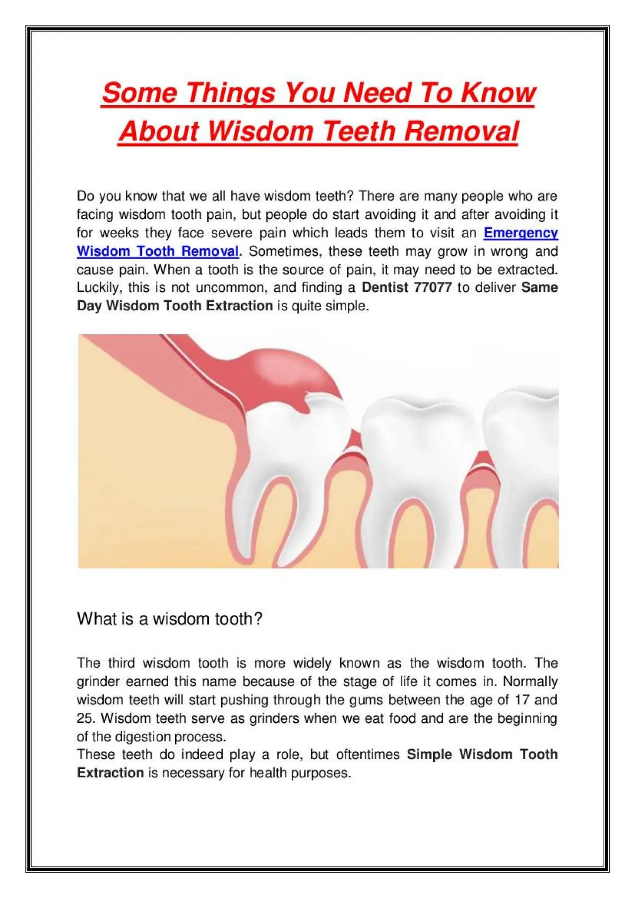 PDF-Some Things You Need To Know About Wisdom Teeth Removal