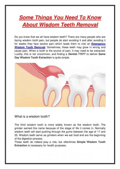 Some Things You Need To Know About Wisdom Teeth Removal