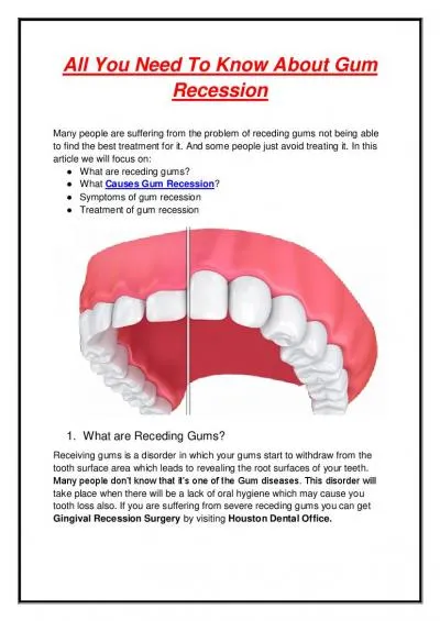 All You Need To Know About Gum Recession