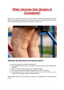 When Varicose Vein Surgery Is Considered?